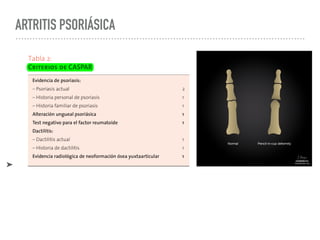 ARTRITIS PSORIÁSICA
➤
 