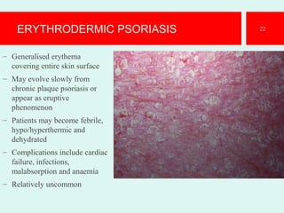 ERYTHRODERMIC PSORIASIS
– Generalised erythema
covering entire skin surface
– May evolve slowly from
chronic plaque psoriasis or
appear as eruptive
phenomenon
– Patients may become febrile,
hypo/hyperthermic and
dehydrated
– Complications include cardiac
failure, infections,
malabsorption and anaemia
– Relatively uncommon
22
 