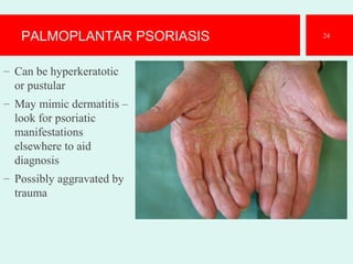 PALMOPLANTAR PSORIASIS
– Can be hyperkeratotic
or pustular
– May mimic dermatitis –
look for psoriatic
manifestations
elsewhere to aid
diagnosis
– Possibly aggravated by
trauma
24
 