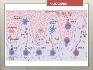 PATOGENIA
 