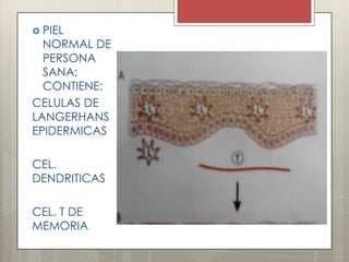  PIEL
NORMAL DE
PERSONA
SANA;
CONTIENE:
CELULAS DE
LANGERHANS
EPIDERMICAS
CEL.
DENDRITICAS
CEL. T DE
MEMORIA
 
