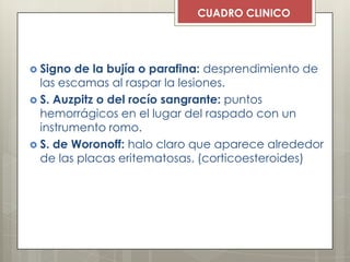  Signo de la bujía o parafina: desprendimiento de
las escamas al raspar la lesiones.
 S. Auzpitz o del rocío sangrante: puntos
hemorrágicos en el lugar del raspado con un
instrumento romo.
 S. de Woronoff: halo claro que aparece alrededor
de las placas eritematosas. (corticoesteroides)
CUADRO CLINICO
 