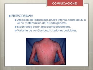  ERITRODERMIA
 Afección de toda la piel, prurito intenso, fiebre de 39 a
40 °C y afectación del estado general.
 Espontanea o por glucocorticoesteroides.
 Variante de von Zumbusch: Lesiones pustulares.
COMPLICACIONES
 