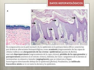 DATOS HISTOPATOLÓGICOS
 