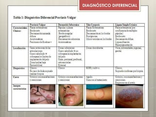 DIAGNÓSTICO DIFERENCIAL
 
