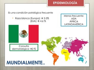 MUNDIALMENTE..
EPIDEMIOLOGÍA
Es una condición patológica frecuente
• Raza blanca (Europa)  2-3%
(EUA)  4.6 %
Menos frecuente:
ASIA
ÁFRICA
LATINOAMÉRICA
Consulta
dermatológica 2 %
 