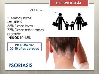 PSORIASIS
EPIDEMIOLOGÍA
AFECTA..
• Ambos sexos
-MUJERES
33% Casos leves
77% Casos moderados
a graves
-NIÑOS 10-15%
• Cualquier edadPREDOMINA:
20-40 años de edad
 