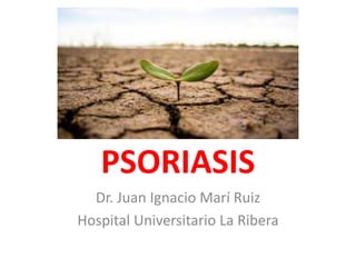 PSORIASIS
Dr. Juan Ignacio Marí Ruiz
Hospital Universitario La Ribera
 