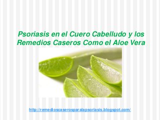 Psoriasis en el Cuero Cabelludo y los
Remedios Caseros Como el Aloe Vera
http://remedioscaserosparalapsoriasis.blogspot.com/
 
