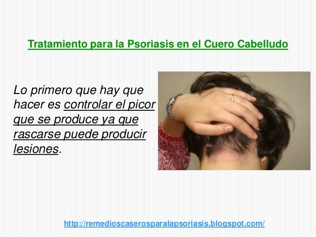Las vitaminas para la psoriasis