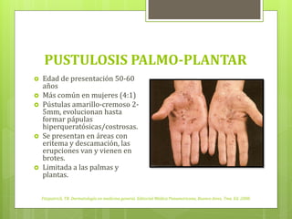 PUSTULOSIS PALMO-PLANTAR
    Edad de presentación 50-60
    años
    Más común en mujeres (4:1)




    Pústulas amarillo-cremoso 2-
    5mm, evolucionan hasta




    formar pápulas



    hiperqueratósicas/costrosas.
    Se presentan en áreas con
    eritema y descamación, las
    erupciones van y vienen en



    brotes.
    Limitada a las palmas y
    plantas.





    Fitzpatrick, TB. Dermatología en medicina general. Editorial Médica Panamericana, Buenos Aires, 7ma. Ed. 2008.
 
