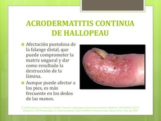 ACRODERMATITIS CONTINUA
         DE HALLOPEAU
    Afectación pustulosa de
    la falange distal, que
    puede comprometer la




    matriz ungueal y dar
    como resultado la
    destrucción de la
    lámina.
    Aunque puede afectar a
    los pies, es más
    frecuente en los dedos




    de las manos.
E. Gallo Gutiérrez y R. Navarro Tejedor. Psoriasis y patología eritemato descamativa. Medicine. 2010;10(47):3131-9
 Fitzpatrick, TB. Dermatología en medicina general. Editorial Médica Panamericana, Buenos Aires, 7ma. Ed. 2008.
 