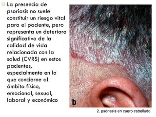 La presencia de psoriasis no suele constituir un riesgo vital para el paciente, pero representa un deterioro significativo de la calidad de vida relacionada con la salud (CVRS) en estos pacientes, especialmente en lo que concierne al ámbito físico, emocional, sexual, laboral y económico 2. psoriasis en cuero cabelludo 