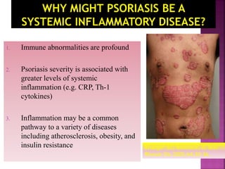 Psoriasis and Management in Primary Care | PPTX
