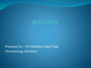 Prepared by :- Dr Monther Fadel Nagi
Dermatology Resident
 