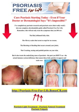 Cure Psoriasis Starting Today - Even if Your
Doctor or Dermatologist Says "It's Impossible!"
   I've compiled my psoriasis research and psoriasis cures (that really work!)
     into one complete, downloadable guide called Psoriasis Free For Life.
       Remember, this will not only treat the symptoms that you DO see:


                          The Red, inflamed itchy skin.


               The Silvery scales that seem to erupt for no reason.


            The Burning or bleeding that occurs around your joints.


            The Cracking, oozing and painful patches on your skin.


But it also treats the underlying cause of psoriasis - the part you DON'T see - the
 actual immune system deficiency that causes these itchy patches to appear and
                                    scale over.




http://Psoriasis-Free-For-Life.BonusCB.com




  Psoriasis Light Treatment - Psoriasis Natural Treatment
                     Psoriasis Vulgaris
 