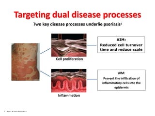 Targeting dual disease processes
1. Ryan S. Br J Nurs 2010;19:822-5
Two key disease processes underlie psoriasis1
Cell proliferation
AIM:
Prevent the infiltration of
inflammatory cells into the
epidermis
AIM:
Reduced cell turnover
time and reduce scale
Inflammation
 