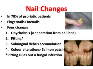 Nail Changes
• In 78% of psoriatic patients
• Fingernails>Toenails
• Four changes
1. Onycholysis (= separation from nail bed)
2. Pitting*
3. Subungual debris accumulation
4. Colour alterations- Salmon patch
*Pitting rules out a fungal infection
 