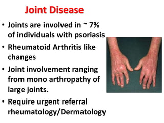 • Joints are involved in ~ 7%
of individuals with psoriasis
• Rheumatoid Arthritis like
changes
• Joint involvement ranging
from mono arthropathy of
large joints.
• Require urgent referral
rheumatology/Dermatology
Joint Disease
 