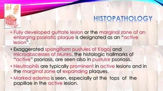 • Fully developed guttate lesion or the marginal zone of an 
enlarging psoriatic plaque is designated as an “active 
lesion”. 
• Exaggerated spongiform pustules of Kogoj and 
microabscesses of Munro, the histologic hallmarks of 
“active” psoriasis, are seen also in pustular psoriasis. 
• Neutrophils are typically prominent in active lesions and in 
the marginal zone of expanding plaques, 
• Marked edema is seen, especially at the tops of the 
papillae in the active lesion. 
 