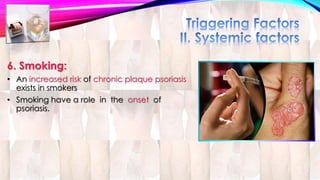 6. Smoking: 
• An increased risk of chronic plaque psoriasis 
exists in smokers 
• Smoking have a role in the onset of 
psoriasis. 
 