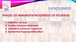PHASES OF IMMUNOPATHOGENESIS OF PSORIASIS 
1. Initiation phase 
2. Innate immune response 
3. Adaptive immune response 
4. Epidermal hyperproliferation 
 