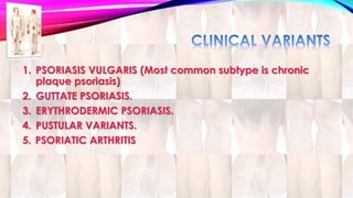 1. PSORIASIS VULGARIS (Most common subtype is chronic 
plaque psoriasis) 
2. GUTTATE PSORIASIS. 
3. ERYTHRODERMIC PSORIASIS. 
4. PUSTULAR VARIANTS. 
5. PSORIATIC ARTHRITIS 
 