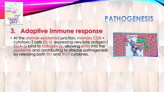 3. Adaptive immune response 
• At the dermal–epidermal junction, memory CD8 + 
cytotoxic T cells (Tc1) expressing very-late antigen-1 
(VLA-1) bind to collagen IV, allowing entry into the 
epidermis and contributing to disease pathogenesis 
by releasing both Th1 and Th17 cytokines. 
 