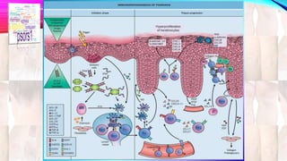 Hyperproliferation 
of keratinocytes 
 