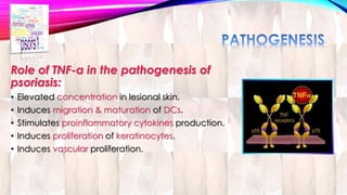 Role of TNF-α in the pathogenesis of 
psoriasis: 
• Elevated concentration in lesional skin. 
• Induces migration & maturation of DCs. 
• Stimulates proinflammatory cytokines production. 
• Induces proliferation of keratinocytes. 
• Induces vascular proliferation. 
 