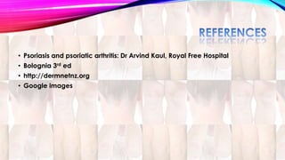• Psoriasis and psoriatic arthritis: Dr Arvind Kaul, Royal Free Hospital 
• Bolognia 3rd ed 
• http://dermnetnz.org 
• Google images 
 