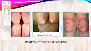 Relatively symmetric distribution. 
 