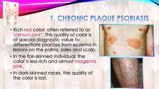 • Rich red color: often referred to as 
'salmon pink‘. This quality of color is 
of special diagnostic value to 
differentiate psoriasis from eczema in 
lesions on the palms, soles and scalp. 
• In the fair-skinned individual, the 
color is less rich and almost magenta 
pink. 
• In dark-skinned races, the quality of 
the color is lost. 
 
