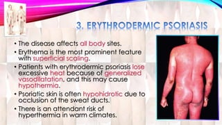 • The disease affects all body sites. 
• Erythema is the most prominent feature 
with superficial scaling. 
• Patients with erythrodermic psoriasis lose 
excessive heat because of generalized 
vasodilatation, and this may cause 
hypothermia. 
• Psoriatic skin is often hypohidrotic due to 
occlusion of the sweat ducts. 
• There is an attendant risk of 
hyperthermia in warm climates. 
 