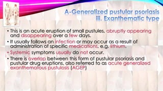 • This is an acute eruption of small pustules, abruptly appearing 
and disappearing over a few days. 
• It usually follows an infection or may occur as a result of 
administration of specific medications, e.g. lithium. 
• Systemic symptoms usually do not occur. 
• There is overlap between this form of pustular psoriasis and 
pustular drug eruptions, also referred to as acute generalized 
exanthematous pustulosis (AGEP) 
 