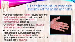 • Characterized by “sterile” pustules of the 
palmoplantar surfaces admixed with 
yellow–brown macules scaly 
erythematous plaques. 
• A minority of patients have chronic 
plaque psoriasis elsewhere. 
• In contrast to the natural history of 
generalized pustular psoriasis, the 
pustules remain localized to the 
palmoplantar surfaces and the course of 
this disease is chronic. 
 