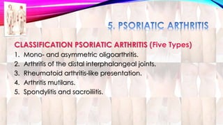 CLASSIFICATION PSORIATIC ARTHRITIS (Five Types) 
1. Mono- and asymmetric oligoarthritis. 
2. Arthritis of the distal interphalangeal joints. 
3. Rheumatoid arthritis-like presentation. 
4. Arthritis mutilans. 
5. Spondylitis and sacroiliitis. 
 