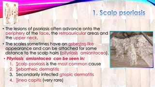• The lesions of psoriasis often advance onto the 
periphery of the face, the retroauricular areas and 
the upper neck. 
• The scales sometimes have an asbestos-like 
appearance and can be attached for some 
distance to the scalp hairs (pityriasis amiantacea). 
• Pityriasis amiantacea can be seen in: 
1. Scalp psoriasis is the most common cause 
2. Seborrheic dermatitis 
3. Secondarily infected atopic dermatitis 
4. Tinea capitis (very rare) 
 