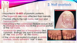 • Reported in 10–80% of psoriatic patients. 
• The fingernails are more affected than toenails. 
• Psoriasis affects the nail matrix, nail bed and 
hyponychium. 
• Nail pitting is the commonest feature occurs due 
to small parakeratotic foci in the proximal portion 
of the nail matrix. 
• Leukonychia and loss of transparency (less 
common findings) are due to involvement 
of the mid portion of the matrix. 
• If the whole nail matrix is involved, a whitish, 
crumbly, poorly adherent “nail” is seen. 
 