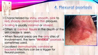 • Characterized by shiny, smooth, pink to 
red, sharply demarcated thin plaques. 
• Scaling is usually minimal or absent. 
• Often a central fissure in the depth of the 
skin crease is seen. 
• When flexural areas are the only sites of 
involvement, the term “INVERSE” psoriasis is 
sometimes used. 
• Localized dermatophyte, candidal or 
bacterial infections can be a trigger for 
flexural psoriasis. 
 