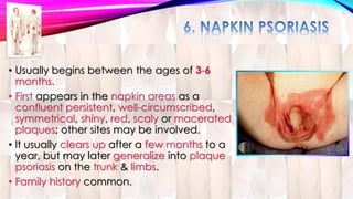 • Usually begins between the ages of 3-6 
months. 
• First appears in the napkin areas as a 
confluent persistent, well-circumscribed, 
symmetrical, shiny, red, scaly or macerated 
plaques; other sites may be involved. 
• It usually clears up after a few months to a 
year, but may later generalize into plaque 
psoriasis on the trunk & limbs. 
• Family history common. 
 