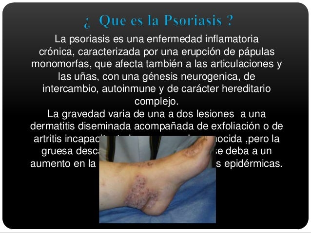 Como coger por la psoriasis
