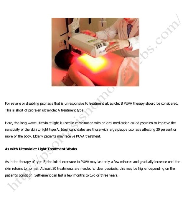 Psoriasis Natural Treatments Ultraviolet Light