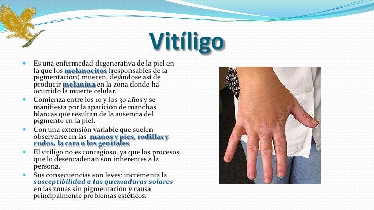 Como arreglar de la persona konopushki las pecas