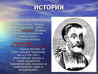 ИСТОРИЯ По свидетельству Роберта Виллана ( Willan , 1809), термин  « psoriasis »  впервые применил знаменитый римский врач и естествоиспытатель  Клавдий Гален  (ок. 129 –   ок. 201 г. до н. э.).   Однако  psoriasis `ом  Гален называл поражение век и углов глаз с образованием чешуек, а также чешуйчатое поражение кожи мошонки со значительным зудом и экскориациями. 