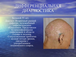 ДИФФЕРЕНЦИАЛЬНАЯ ДИАГНОСТИКА Больной 55 лет.  Диагноз: Вторичный ранний сифилис, осложнённый сифилитическим облысением. Представлен псориазиформными сифилидами в области головы и подошв. Сопутствующая проблема – полная потеря зрения, связанная с употреблением технического спирта. 