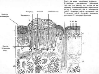 СХЕМА СТРОЕНИЯ КОЖИ  ПРИ ПСОРИАЗЕ 