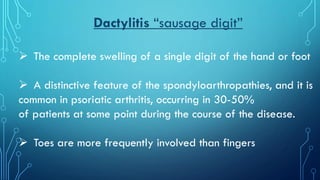 Psoriatic arthritis | PDF