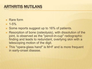 ARTHRITIS MUTILANS









Rare form
1-5%
Some reports suggest up to 16% of patients.
Resorption of bone (osteolysis), with dissolution of the
joint, is observed as the "pencil-in-cup" radiographic
finding and leads to redundant, overlying skin with a
telescoping motion of the digit.
This "opera-glass hand" is M>F and is more frequent
in early-onset disease.

 