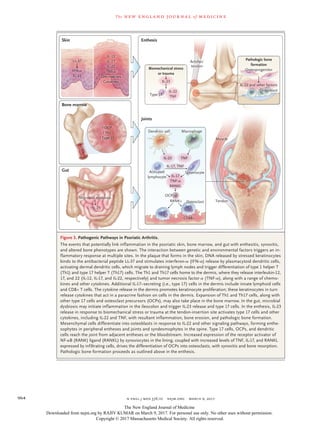 n engl j med 376;10 nejm.org March 9, 2017964
The new engl and jour nal of medicine
Figure 3. Pathogenic Pathways in Psoriatic Arthritis.
The events that potentially link inflammation in the psoriatic skin, bone marrow, and gut with enthesitis, synovitis,
and altered bone phenotypes are shown. The interaction between genetic and environmental factors triggers an in-
flammatory response at multiple sites. In the plaque that forms in the skin, DNA released by stressed keratinocytes
binds to the antibacterial peptide LL-37 and stimulates interferon-α (IFN-α) release by plasmacytoid dendritic cells,
activating dermal dendritic cells, which migrate to draining lymph nodes and trigger differentiation of type 1 helper T
(Th1) and type 17 helper T (Th17) cells. The Th1 and Th17 cells home to the dermis, where they release interleukin-12,
17, and 22 (IL-12, IL-17, and IL-22, respectively) and tumor necrosis factor α (TNF-α), along with a range of chemo-
kines and other cytokines. Additional IL-17–secreting (i.e., type 17) cells in the dermis include innate lymphoid cells
and CD8+ T cells. The cytokine release in the dermis promotes keratinocyte proliferation; these keratinocytes in turn
release cytokines that act in a paracrine fashion on cells in the dermis. Expansion of Th1 and Th17 cells, along with
other type 17 cells and osteoclast precursors (OCPs), may also take place in the bone marrow. In the gut, microbial
dysbiosis may initiate inflammation in the ileocolon and trigger IL-23 release and type 17 cells. In the enthesis, IL-23
release in response to biomechanical stress or trauma at the tendon-insertion site activates type 17 cells and other
cytokines, including IL-22 and TNF, with resultant inflammation, bone erosion, and pathologic bone formation.
Mesenchymal cells differentiate into osteoblasts in response to IL-22 and other signaling pathways, forming enthe-
sophytes in peripheral entheses and joints and syndesmophytes in the spine. Type 17 cells, OCPs, and dendritic
cells reach the joint from adjacent entheses or the bloodstream. Increased expression of the receptor activator of
NF-κB (RANK) ligand (RANKL) by synoviocytes in the lining, coupled with increased levels of TNF, IL-17, and RANKL
expressed by infiltrating cells, drives the differentiation of OCPs into osteoclasts, with synovitis and bone resorption.
Pathologic bone formation proceeds as outlined above in the enthesis.
Biomechanical stress
or trauma
Enthesis
Joints
Achilles’
tendon
Tendon
Muscle
IL-23
IL-22 and other factors
Pathologic bone
formation
IL-22
TNFType 17
Osteoblast
Osteoclast
CD68+
Osteoprogenitor
MacrophageDendritic cell
Activated
lymphocyte
IL-23
IL-17, TNF
TNF
IL-17
TNF-α
RANKL
RANK+
Skin
Gut
LL-37
IL-12
IL-17
IL-22
TNF-α
Chemokines
Cytokines
↑OCP
↑Th1
↑Type 17
IFN-α
IL-23
Bone marrow
Microbial dysbiosis
↑IL-23
Synoviocyte
OCP
The New England Journal of Medicine
Downloaded from nejm.org by RAJIV KUMAR on March 9, 2017. For personal use only. No other uses without permission.
Copyright © 2017 Massachusetts Medical Society. All rights reserved.
 